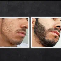 با کارت گارانتی رشدش بده طی ۱۸ روز