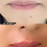 لیزر موهای زائد با قیمت باور نکردنی 550 فول بادی|خدمات آرایشگری و زیبایی|کرج, گلشهر|دیوار