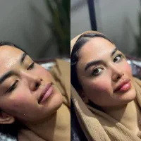 ژل لب بوتاکس فیلر مزو ژل یانگ فیس پی ارپی نخ لیفت|خدمات آرایشگری و زیبایی|مشهد, احمدآباد|دیوار