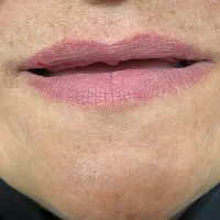 ۲۰درصد تخفیف دندان مصنوعی بدون لقی با گارانتی|خدمات آرایشگری و زیبایی|مشهد, موسوی قوچانی|دیوار