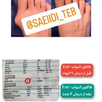 رماتیسم،نقرس ،ارتریت روماتوئید|آرایشی، بهداشتی، درمانی|بندر انزلی, گیلار|دیوار