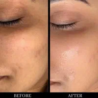 سفیدکردن‌نواحی تیره بدن|خدمات آرایشگری و زیبایی|ارومیه, |دیوار