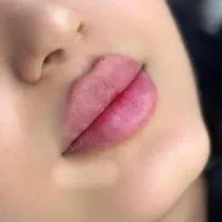 جشنواره تخفیفی فیلر بوتاکس انزیم مزو سیئل