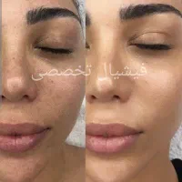 رنگ و کوتاهی و احیا و ابریشم سازی مو تخصصی|خدمات آرایشگری و زیبایی|بندرعباس, |دیوار