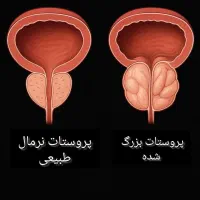 بازگشت و درمان طبیعی بدون قرص و اسپری|آرایشی، بهداشتی، درمانی|زنجان, |دیوار