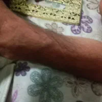 درمان دیسک کمر درمان رگ به رگ