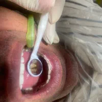 خدمات دندانپزشکی با کمترین قیمت زیر نظر متخصص