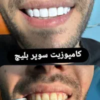 دندانپزشکی|خدمات آرایشگری و زیبایی|تهران, خاک سفید|دیوار