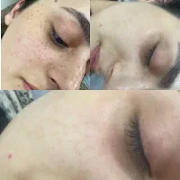 تخصصی ترین حرفه ای ترین مرکزدرمان انواع لک وکک مک|خدمات زیبایی و سلامت|تهران, سیزده آبان|دیوار