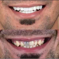 کلیه خدمات دندانپزشکی مناسب همه|خدمات آرایشگری و زیبایی|کرمانشاه, |دیوار