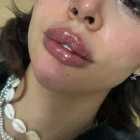 تزریق ژل و بوتاکس وخدمات پیرسینگ