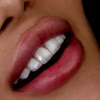 دندانپزشکی،قیمت مناسب،اقساطی ایمپلنت درمانی زیبایی