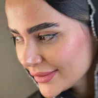 عمل جراحی بینی /لیفت صورت