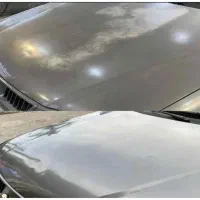 رفع آفتاب سوختگی