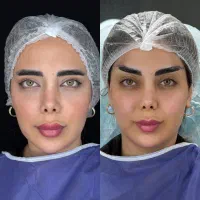 زیبایی ابرو و بلفارو|خدمات آرایشگری و زیبایی|تهران, سازمان برنامه جنوبی|دیوار