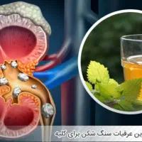 سنگ خرد کن کلیه