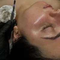 درماپلینیگ