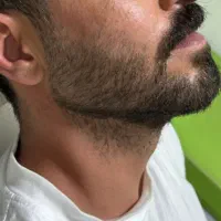 تزریق ژل و بوتاکس|خدمات آرایشگری و زیبایی|اصفهان, گلزار|دیوار