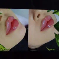 زیبایی