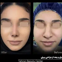 کاشت مو، کاشت ابرو، بلفارو، عمل بینی، رفع غبغب|خدمات آرایشگری و زیبایی|کرج, فاز ۱ مهرشهر|دیوار