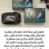 صابون کربن سیاه درمانی( اصل اصل)|آرایشی، بهداشتی، درمانی|اهواز, منبع اب|دیوار