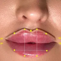 بوتاکس فیلر  ژل  توسط پزشک متخصص