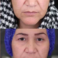 بلفارو پلاستی|خدمات آرایشگری و زیبایی|ری, علایین|دیوار