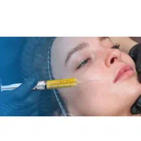 تزریق چربی و لابیاپلاستی وجراحی پلک