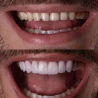 تخفیف ویژه کامپوزیت و خدمات دندانپزشکی|خدمات آرایشگری و زیبایی|اسلام‌شهر, باغ فیض|دیوار