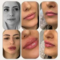 کلینیک زیبایی دکتر حسینی در اقدسیه|خدمات زیبایی و سلامت|تهران, آجودانیه|دیوار