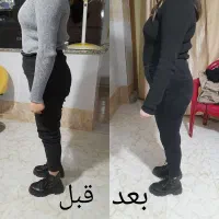 چاقی کل اندام و صورت