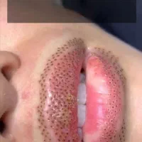 پاکسازی و جوانسازی پوست صورت