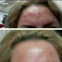 درمان مشکلات پوستی