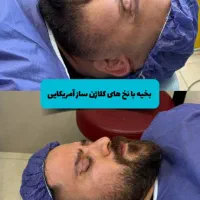 بلفاروپلاستی/تخصصی/ضمانت نامه کتبی رد بخیه