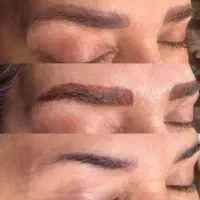 ریموو ابرو تک جلسه ای  تضمینی