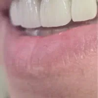 لابراتوار دندانسازی