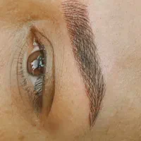 فیبروز . اصلاح صورت و ابرو .موخوره گیری