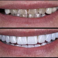 خدمات دندانپزشکی تخصصی کلینیک دی با اقساط بلند مدت|خدمات آرایشگری و زیبایی|پارسآباد, |دیوار