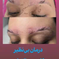 ترمیم و بازسازی انواع ناهنجاری های پوستی|خدمات آرایشگری و زیبایی|شیراز, قصرالدشت|دیوار