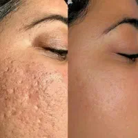 اولین مرکز سم زدایی بدن در پردیسان