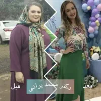 اسلیو و بایپس معده مشاوره با دکتر محمد یرانی|خدمات زیبایی و سلامت|تهران, درختی|دیوار
