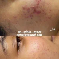 پاکسازی پوست وفیشیال
