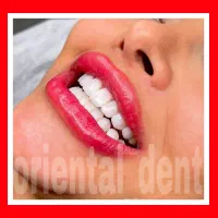 بریج و کامپوزیت و لیفت لثه جرمگیری دندان عصبکشی|خدمات آرایشگری و زیبایی|تهران, تهرانپارس غربی|دیوار