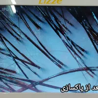 اسکراب اسکالپ تخصصی|خدمات آرایشگری و زیبایی|محمودآباد, |دیوار