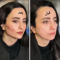 ژل لب فقط ۵۸۰