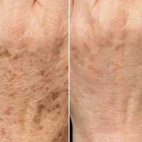 کامپوزیت دندان لیزرمو ژل بوتاکس فیلر مزو پی ارپی|خدمات آرایشگری و زیبایی|اسلامشهر, زرافشان|دیوار