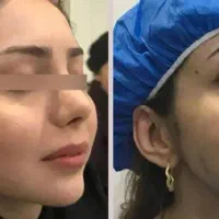 کلینیک پیکرتراشی لیپو،ابدو،پروتز،مامو،تزریق چربی|خدمات آرایشگری و زیبایی|تهران, اقدسیه|دیوار