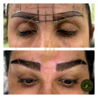 کلینیک تخصصی ابرو در سنندج
