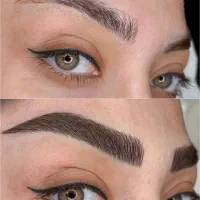 آف فیبروز،میکروکاشت،شیدینگ گرگان فقط ۸۷۰