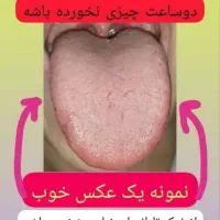 سلامتی ریشه ای با پک پاکسازی